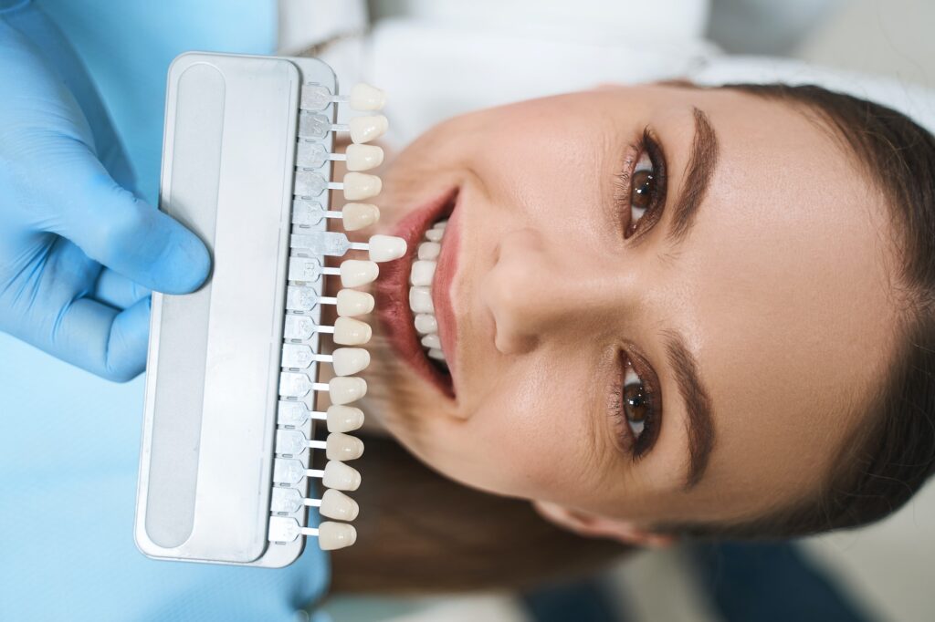 Porcelain Veneers - Kauai Dental Care